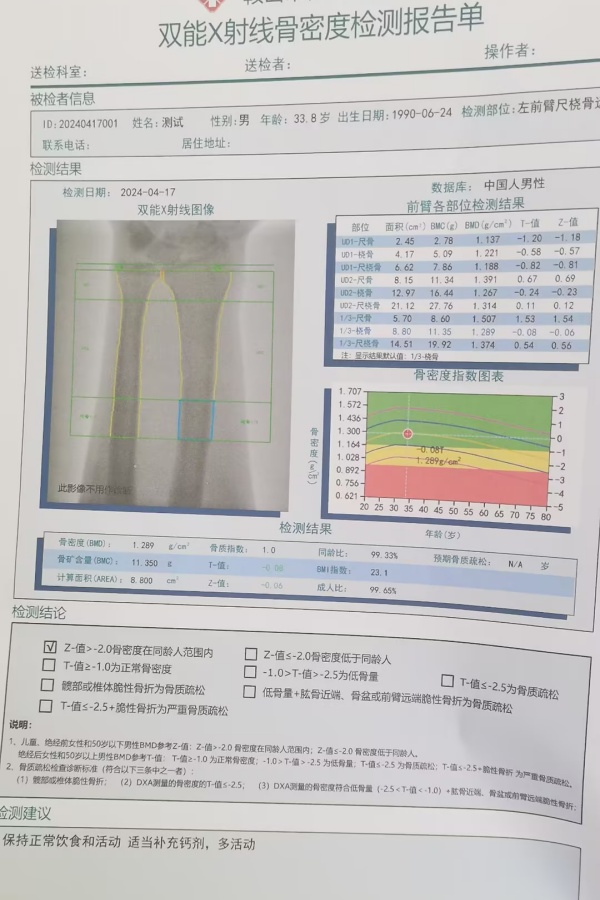 雙能X射線骨密度儀：準(zhǔn)確測(cè)量骨密度，助力骨質(zhì)疏松防治，守護(hù)骨骼健康